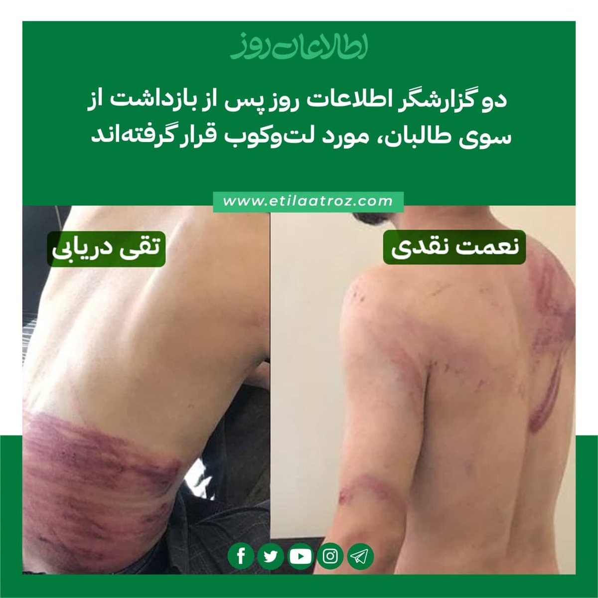 Reporters of Etilaatroz, Taqi Daryabi and Nematullah Naqdi, have been severely beaten by the Taliban after their arrest. Injuries of the physical abuse are clearly visible on their face and bodies