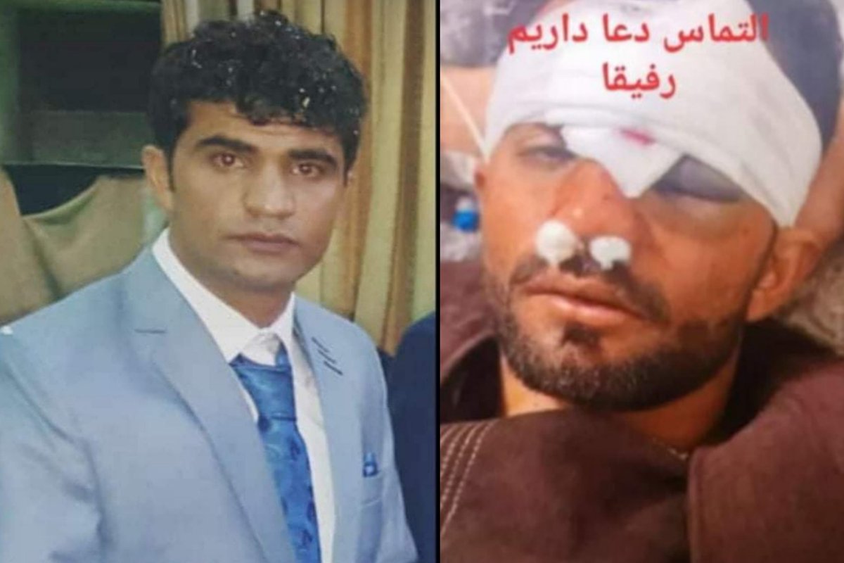 This ex-member of police for PD6 of Kabul died after being brutally tortured by the Taliban. His close relatives told that he couldnt endure his wounds, so 1 day after the torture, he died at the hospital.  This is d 2nd ex-military killed by Taliban in the past 1 week in west Kabul